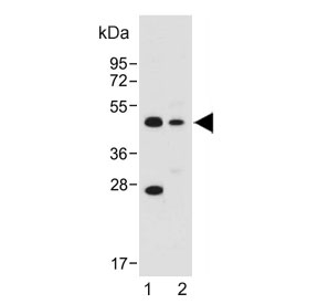 Western blot testing of 1) human HepG2 and 2) mouse brain lysate with ASAM antibody. Predicted molecular weight ~41 kDa.