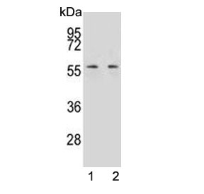 Western blot testing of human 1) K562 and 2) NCI-H292 cell lysate with MPP3 antibody. Predicted molecular weight ~66 kDa.