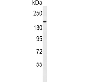 Western blot testing of human MDA-MB-435 cell lysate with Protocadherin 9 antibody. Expected molecular weight: 136-180 kDa.