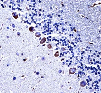 IHC testing of FFPE mouse cerebellum tissue with CKI-gamma 3 antibody. HIER: steam section in pH6 citrate buffer for 20 min and allow to cool prior to staining.