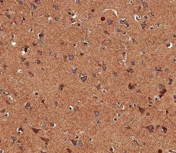 IHC testing of FFPE human brain tissue with TRPV1 antibody. HIER: steam section in pH6 citrate buffer for 20 min and allow to cool prior to staining.