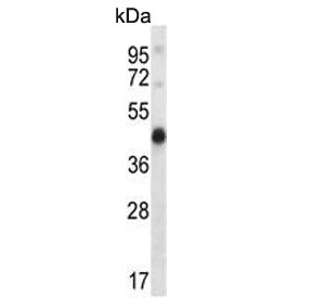Western blot testing of mouse heart cell lysate with Pyruvate dehydrogenase kinase 2 antibody. Predicted molecular weight ~46 kDa.