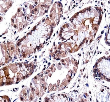 DLX5 Antibody Human Stomach IHC. Immunohistochemical analysis of FFPE human stomach tissue using DLX5 Antibody. Heat-induced epitope retrieval was performed in pH 6.0 citrate buffer prior to incubation with the primary antibody. An HRP-conjugated secondary antibody with DAB chromogen was used for visualization. Moderate to strong nuclear staining with accompanying cytoplasmic signal is observed in the gastric epithelial cells, consistent with the expected localization of DLX5 as a homeobox transcription factor. These results demonstrate that DLX5 Antibody, a Homeobox Transcription Factor Antibody, specifically detects endogenous DLX5 in FFPE human stomach tissue.