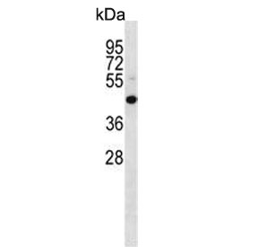 Western blot testing of mouse NIH 3T3 cell lysate with MEK4 antibody. Predicted molecular weight ~44 kDa.