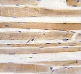 IHC testing of FFPE human skeletal muscle tissue with ATG4A antibody. HIER: steam section in pH6 citrate buffer for 20 min and allow to cool prior to staining.
