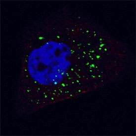 Immunofluorescent staining of fixed and permeabilized human U-251 cells (treated with 50 uM Chloroquine for 16 hr) with ATG4B antibody (green) and Hoechst 33342 nuclear stain (blue).