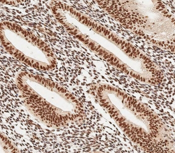 IHC testing of FFPE human uterus tissue with MOX-2 antibody. HIER: steam section in pH9 EDTA for 20 min and allow to cool prior to staining.