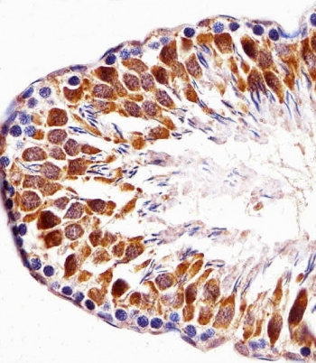IHC testing of FFPE rat testis tissue with TOPK antibody. HIER: steam section in pH6 citrate buffer for 20 min and allow to cool prior to staining.