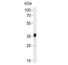 Western blot testing of mouse testis tissue lysate with TOPK antibody. Predicted molecular weight ~36 kDa.
