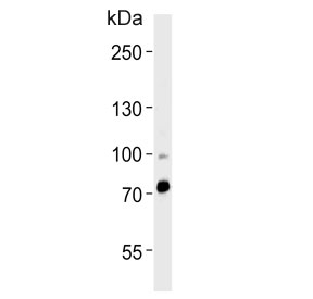 ZNF219 Antibody Human Heart WB. Western blot testing of human heart tissue lysate with ZNF219 Antibody. Predicted molecular weight: ~77 kDa. ZNF219 Antibody / Zinc Finger Transcription Factor Antibody detects a major band consistent with Zinc Finger Protein 219 expression and supports studies of DNA-binding proteins, transcriptional regulation and gene expression control pathways.