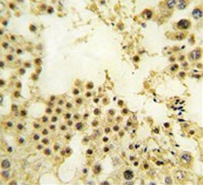 ZNF219 Antibody Human Testis IHC. Immunohistochemistry staining of FFPE human testis tissue with ZNF219 Antibody. HIER was performed by steaming tissue sections in pH 6 citrate buffer for 20 minutes, followed by cooling prior to staining. The section was incubated with ZNF219 antibody and developed using chromogenic detection. ZNF219 Antibody / Zinc Finger Transcription Factor Antibody demonstrates nuclear staining consistent with Zinc Finger Protein 219 expression and supports studies of DNA-binding proteins, transcriptional regulation and gene expression control pathways.