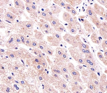 IHC testing of FFPE human liver tissue with PPP2R2A antibody. HIER: steam section in pH6 citrate buffer for 20 min and allow to cool prior to staining.