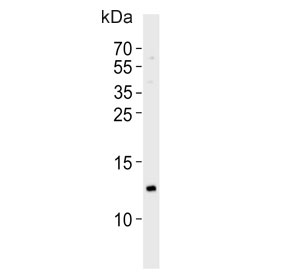 Western blot testing of human brain tissue lysate with Hemoglobin subunit gamma-2 antibody. Predicted molecular weight ~16 kDa.