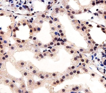 IHC testing of FFPE human kidney tissue with CSNK2A1 antibody. HIER: steam section in pH6 citrate buffer for 20 min and allow to cool prior to staining.