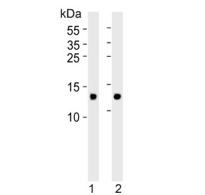 FABP3 Antibody Heart and Skeletal Muscle WB. Western blot testing of human 1) heart and 2) skeletal muscle tissue lysate with FABP3 antibody. Predicted molecular weight ~15 kDa.