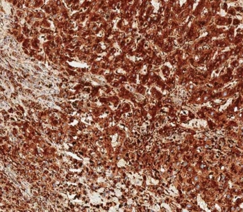 IHC testing of FFPE human liver tissue with Cathepsin D antibody. HIER: steam section in pH9 EDTA for 20 min and allow to cool prior to staining.