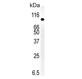 Western blot testing of mouse kidney tissue lysate with SMURF1 antibody. Expected molecular weight ~86 kDa.