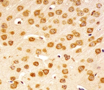 IHC testing of FFPE mouse brain tissue with Nr4a2 antibody. HIER: steam section in pH6 citrate buffer for 20 min and allow to cool prior to staining.