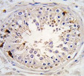 IHC testing of FFPE human testis tissue with USP2 antibody. HIER: steam section in pH6 citrate buffer for 20 min and allow to cool prior to staining.