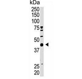 Western blot testing of mouse heart tissue lysate with SUMO-activating enzyme subunit 1 antibody. Predicted molecular weight ~38 kDa.