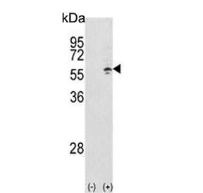 Western blot testing of 1) non-transfected and 2) transfected 293 cell lysate with TCP1 gamma antibody.