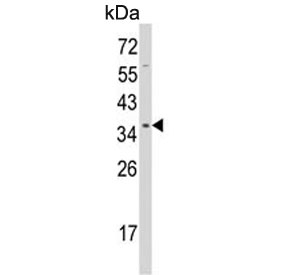 Western blot testing of human HeLa cell lysate with UNRIP antibody. Predicted molecular weight ~38 kDa.