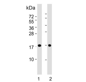 PPIA Antibody A431 and HeLa WB. Western blot analysis of 1) human A431 and 2) human HeLa cell lysates using PPIA Antibody demonstrates strong immunoreactive bands at approximately 18 kDa in both cell lines, consistent with the expected molecular weight of PPIA (Cyclophilin A). PPIA is a ubiquitously expressed peptidyl-prolyl cis-trans isomerase that functions as a molecular chaperone involved in protein folding, intracellular signaling, and cellular stress response pathways. The detection of a single prominent band in both epithelial-derived cell lines supports specific recognition of endogenous PPIA and demonstrates the utility of this antibody for western blot applications.