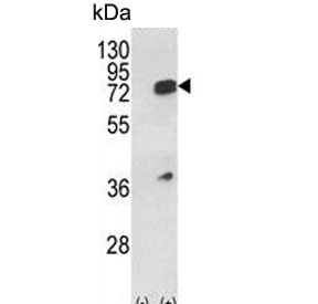 Western blot testing of 1) non-transfected and 2) transfected 293 cell lysate with HNRPL antibody.