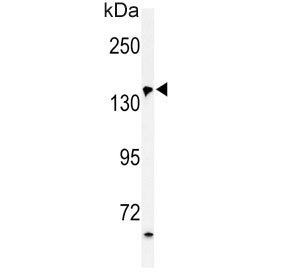 Western blot testing of human HepG2 cell lysate with PFAS antibody. Predicted molecular weight ~145 kDa.