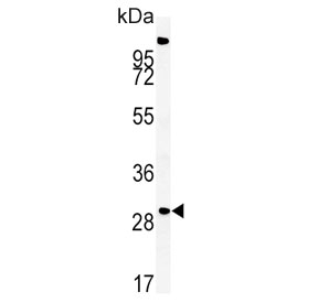 Western blot testing of mouse liver tissue lysate with ZDHHC21 antibody. Predicted molecular weight ~31 kDa.