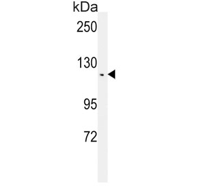 Western blot testing of human CCRF-CEM cell lysate with Teashirt homolog 2 antibody. Predicted molecular weight ~115 kDa.
