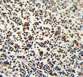 IHC testing of FFPE human lymph node tissue with Lymphocyte Specific Protein 1 antibody. HIER: steam section in pH6 citrate buffer for 20 min and allow to cool prior to staining.