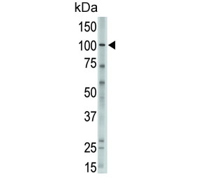 Western blot testing of human A375 cell lysate with Major Vault Protein antibody. Expected molecular weight: 104~110 kDa.