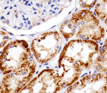 REDD-1 Antibody Human Kidney IHC. IHC staining of FFPE human kidney tissue with REDD-1 antibody demonstrated strong cytoplasmic staining of renal tubular epithelial cells, consistent with the expression pattern of REDD-1 (DDIT4), a stress-responsive regulator of mTOR signaling and cellular metabolism. REDD-1 is induced by hypoxia, oxidative stress, nutrient deprivation, and other cellular stressors, where it functions to suppress mTOR activity and promote adaptive survival responses. The prominent staining observed within renal tubules is consistent with the high metabolic activity of these cells and the importance of stress-response pathways in maintaining renal homeostasis. Heat-induced epitope retrieval was performed by steaming tissue sections in pH 6 citrate buffer for 20 minutes and allowing them to cool prior to staining. These results support the utility of REDD-1 Antibody for studies of hypoxia signaling, mTOR pathway regulation, cellular stress responses, and kidney biology.