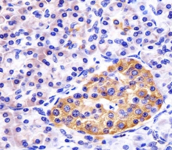 REDD-1 Antibody Human Pancreas IHC. IHC staining of FFPE human pancreas tissue with REDD-1 antibody demonstrated moderate to strong cytoplasmic staining of pancreatic epithelial cells, with particularly prominent staining within islet cell populations. REDD-1, also known as DDIT4 (DNA Damage Inducible Transcript 4), is a stress-responsive regulator of mTOR signaling that is induced by hypoxia, oxidative stress, nutrient deprivation, and metabolic challenges. By suppressing mTOR activity, REDD-1 helps coordinate cellular adaptation and energy conservation under adverse conditions. The staining pattern observed is consistent with the high metabolic activity of pancreatic tissues and the importance of stress-response pathways in maintaining cellular homeostasis. Heat-induced epitope retrieval was performed by steaming tissue sections in pH 6 citrate buffer for 20 minutes and allowing them to cool prior to staining. These results support the utility of REDD-1 Antibody for studies of mTOR pathway regulation, cellular stress responses, metabolism, and pancreatic biology.