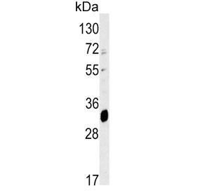 Western blot testing of mouse liver tissue lysate with ELOVL6 antibody. Predicted molecular weight ~31 kDa.