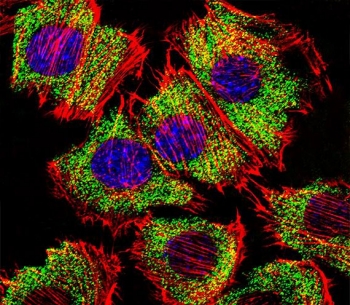 Immunofluorescent staining of fixed and permeabilized mouse C2C12 cells with ENO1 antibody (green), DAPI nuclear stain (blue) and anti-Actin (red).