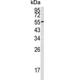EEF1A1/2 Antibody Human MCF7 WB. Western blot analysis of EEF1A1/2 expression was performed using anti-EEF1A1/2 antibody in human MCF7 cell lysate. EEF1A1 and EEF1A2, also known as eukaryotic elongation factor 1 alpha proteins, are highly conserved GTP-binding factors that mediate aminoacyl-tRNA delivery during the elongation phase of protein synthesis. A prominent immunoreactive band is detected at approximately 50 kDa, corresponding to the predicted molecular weight of EEF1A1/2. Strong expression in MCF7 breast carcinoma cells is consistent with the abundant and ubiquitous nature of eEF1A proteins and their essential roles in translational control, cytoskeletal organization, and cellular proliferation. These results support the utility of EEF1A1/2 Antibody for studies of protein synthesis, cell growth, and cancer biology.