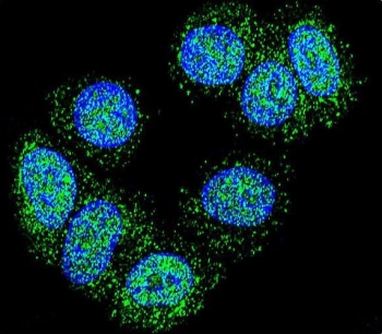 EEF1A1/2 Antibody Human MCF7 IF. Immunofluorescent staining of human MCF7 cells with EEF1A1/2 antibody revealed abundant cytoplasmic staining with a finely punctate distribution consistent with the localization of eukaryotic elongation factor 1 alpha proteins involved in protein synthesis and translational control. EEF1A1 and EEF1A2 are highly conserved GTP-binding proteins that mediate aminoacyl-tRNA delivery to ribosomes and additionally participate in cytoskeletal organization and cellular stress responses. Green fluorescence indicates EEF1A1/2 expression, while nuclei are counterstained with DAPI (blue). The widespread cytoplasmic staining pattern is consistent with the abundant expression of eEF1A proteins and their essential roles in maintaining cellular growth and metabolism. These results support the utility of EEF1A1/2 Antibody for studies of protein synthesis, cell proliferation, and cancer biology.