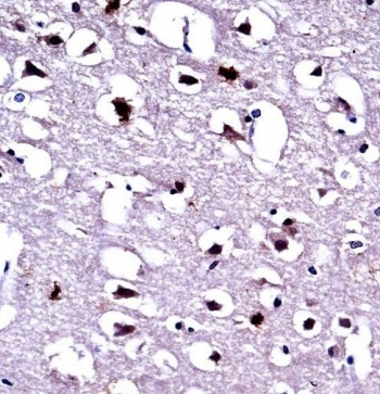 EEF1A1/2 Antibody Human Brain IHC. IHC staining of FFPE human brain tissue with EEF1A1/2 antibody demonstrated strong cytoplasmic staining of neuronal cell bodies, consistent with the expression pattern of eukaryotic elongation factor 1 alpha proteins involved in translational control and cellular homeostasis. EEF1A1 and EEF1A2 are highly conserved GTP-binding proteins that mediate aminoacyl-tRNA delivery during protein synthesis, with EEF1A2 being particularly enriched in neurons and muscle tissue. The prominent neuronal staining observed is consistent with the high metabolic demands and protein synthesis requirements of the central nervous system. Heat-induced epitope retrieval was performed by steaming tissue sections in pH 6 citrate buffer for 20 minutes and allowing them to cool prior to immunostaining. These results support the utility of EEF1A1/2 Antibody for studies of neurobiology, protein synthesis, and cellular metabolism.