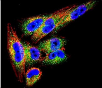 Immunofluorescent staining of human A2058 cells with TIMP1 antibody (green), DAPI nuclear stain (blue) and anti-Actin (red).