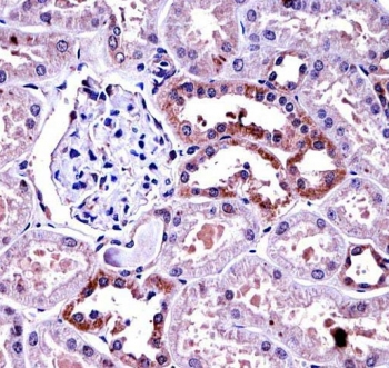 Immunohistochemistry of M-CSF antibody in human kidney tissue. FFPE human kidney was subjected to heat-induced epitope retrieval by steaming sections in pH 6 citrate buffer for 20 minutes followed by cooling prior to staining. M-CSF antibody demonstrates cytoplasmic HRP-DAB brown staining predominantly in renal tubular epithelial cells, with minimal staining in glomerular structures. The staining pattern is consistent with localized expression of Macrophage colony stimulating factor within tubular epithelium.