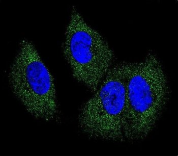 Immunofluorescence of M-CSF antibody in human MDA-MB-231 cells. Cells were stained with M-CSF antibody (green) and counterstained with DAPI (blue) to visualize nuclei. Fluorescent signal demonstrates predominantly cytoplasmic distribution with a diffuse and punctate pattern surrounding the DAPI-positive nuclei, consistent with intracellular localization of Macrophage colony stimulating factor within tumor-derived epithelial cells.