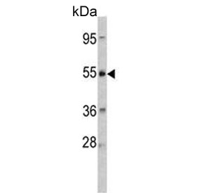 Western blot testing of human HeLa cell lysate with Corticotropin-releasing factor receptor 2 antibody. Predicted molecular weight ~48 kDa.