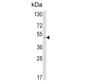 Western blot testing of mouse cerebellum tissue lysate with Endothelin B Receptor antibody. Expected molecular weight of EDNRB is ~49â59 kDa (predicted), but the receptor consistently migrates around ~45 kDa on SDS-PAGE, often appearing as a single or doublet band depending on glycosylation state. This pattern is well-documented in peer-reviewed studies.