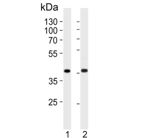 Calponin 1 Antibody HeLa and MDA-MB-453 WB. Western blot testing of human 1) HeLa and 2) MDA-MB-453 cell lysate with Calponin 1 antibody. Predicted molecular weight ~33 kDa.
