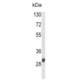 Western blot testing of mouse kidney tissue lysate with NAT2 antibody. Predicted molecular weight ~33 kDa.
