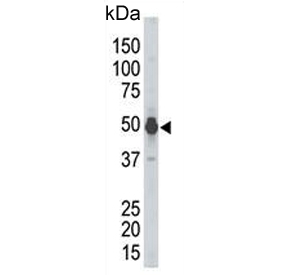 Western blot testing of mouse kidney tissue lysate with PHKG2 antibody. Predicted molecular weight ~44 kDa.