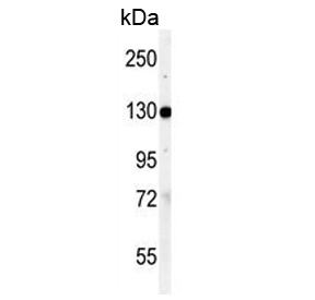 Western blot testing of human K562 cell lysate with VCL antibody. Predicted molecular weight ~124 kDa.