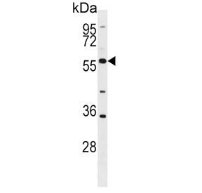Western blot testing of human HL60 cell lysate with BLK antibody. Expected molecular weight: 55-58 kDa.